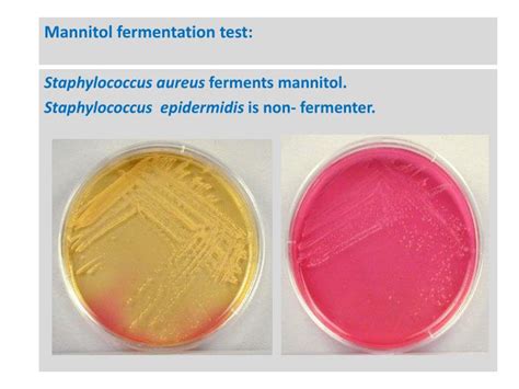 mannitol fermentation test|mannitol test for bacteria.